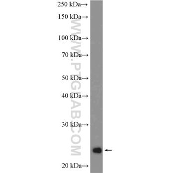 RALB Rabbit Polyclonal Antibody (12340-1-AP)