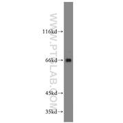 ARMCX2 Rabbit Polyclonal Antibody (12200-1-AP)