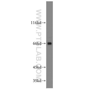 ARMCX2 Rabbit Polyclonal Antibody (12200-1-AP)