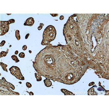 UCN2 Rabbit Polyclonal Antibody (12198-1-AP)