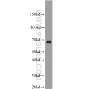 SAMHD1 Rabbit Polyclonal Antibody (12586-1-AP)