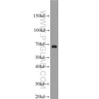 SAMHD1 Rabbit Polyclonal Antibody (12586-1-AP)