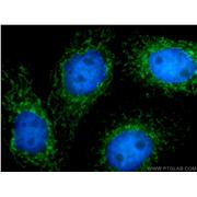 IFIT2 Rabbit Polyclonal Antibody (12604-1-AP)