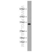CBY1 Rabbit Polyclonal Antibody (12239-1-AP)