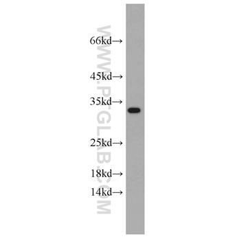 CBY1 Rabbit Polyclonal Antibody (12239-1-AP)