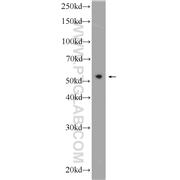 PDCD7 Rabbit Polyclonal Antibody (12485-1-AP)