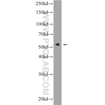 PDCD7 Rabbit Polyclonal Antibody (12485-1-AP)