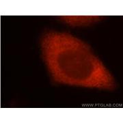 TOMM34 Rabbit Polyclonal Antibody (12196-1-AP)