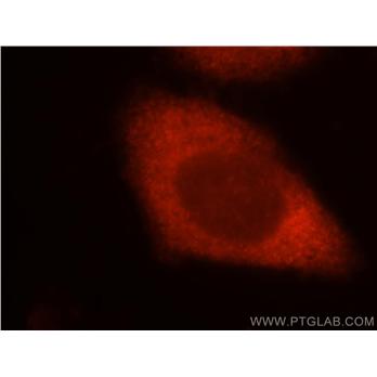 TOMM34 Rabbit Polyclonal Antibody (12196-1-AP)