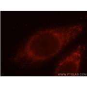 ETFA Rabbit Polyclonal Antibody (12262-1-AP)