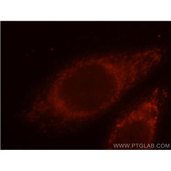 ETFA Rabbit Polyclonal Antibody (12262-1-AP)