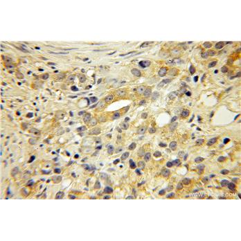 EDF1 Rabbit Polyclonal Antibody (12419-1-AP)