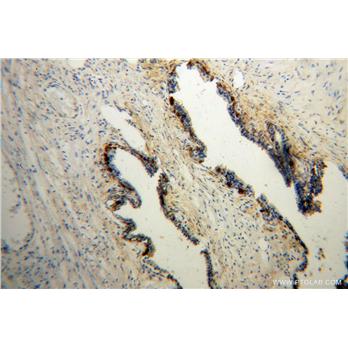 CRYM Rabbit Polyclonal Antibody (12495-1-AP)