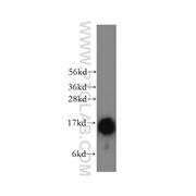 TRAPPC2 Rabbit Polyclonal Antibody (12484-1-AP)