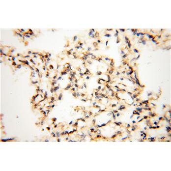 MAT1A Rabbit Polyclonal Antibody (12395-1-AP)