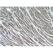 GUCY1A3 Rabbit Polyclonal Antibody (12605-1-AP)