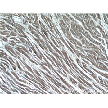 GUCY1A3 Rabbit Polyclonal Antibody (12605-1-AP)