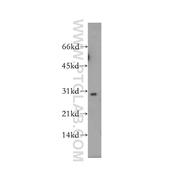 SCO1 Rabbit Polyclonal Antibody (12614-1-AP)