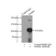 SORT1 Rabbit Polyclonal Antibody (12369-1-AP)
