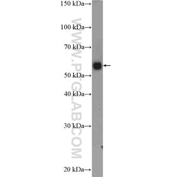 SERPING1 Rabbit Polyclonal Antibody (12259-1-AP)