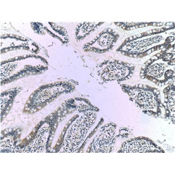 KCNJ13 Rabbit Polyclonal Antibody (12657-1-AP)