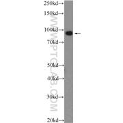 PDCD6IP Rabbit Polyclonal Antibody (12422-1-AP)