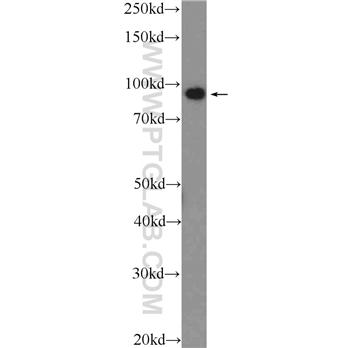 PDCD6IP Rabbit Polyclonal Antibody (12422-1-AP)