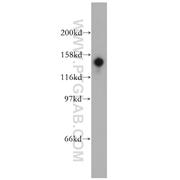 STK36 Rabbit Polyclonal Antibody (12559-1-AP)