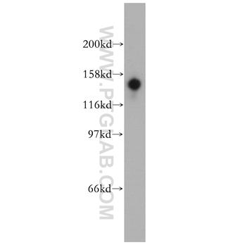 STK36 Rabbit Polyclonal Antibody (12559-1-AP)