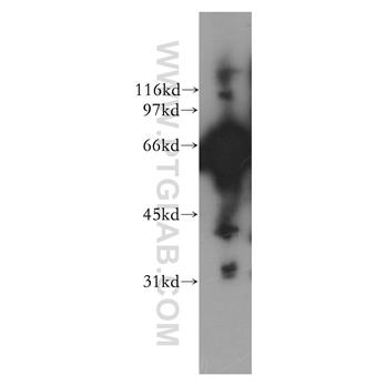 AK5 Rabbit Polyclonal Antibody (12510-2-AP)