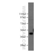 FNTA Rabbit Polyclonal Antibody (12274-1-AP)