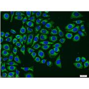 CLIC4 Rabbit Polyclonal Antibody (12298-2-AP)