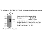 ZNF238 Rabbit Polyclonal Antibody (12714-1-AP)