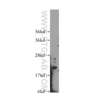 IMP3 Rabbit Polyclonal Antibody (12750-1-AP)