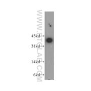 MKI67IP Rabbit Polyclonal Antibody (12615-1-AP)
