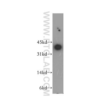 MKI67IP Rabbit Polyclonal Antibody (12615-1-AP)