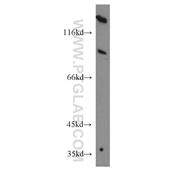 ACO1 Rabbit Polyclonal Antibody (12406-1-AP)