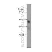 TULP2 Rabbit Polyclonal Antibody (12668-1-AP)