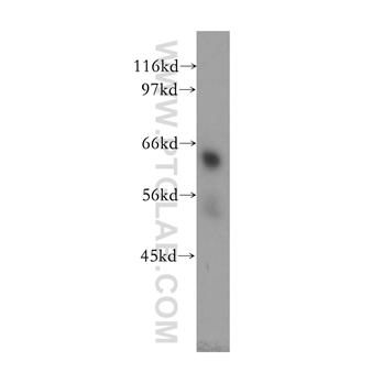 TULP2 Rabbit Polyclonal Antibody (12668-1-AP)