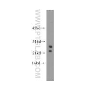 TBPL1 Rabbit Polyclonal Antibody (12258-1-AP)