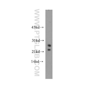 TBPL1 Rabbit Polyclonal Antibody (12258-1-AP)