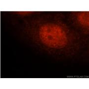 FAM107A Rabbit Polyclonal Antibody (12176-1-AP)