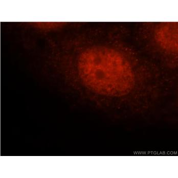 FAM107A Rabbit Polyclonal Antibody (12176-1-AP)