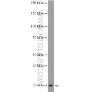MXI1 Rabbit Polyclonal Antibody (12360-1-AP)