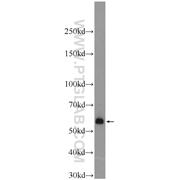 BMPR1A Rabbit Polyclonal Antibody (12702-1-AP)