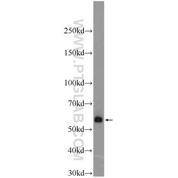 BMPR1A Rabbit Polyclonal Antibody (12702-1-AP)