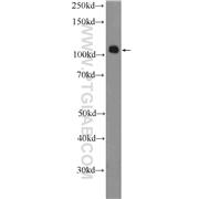 SMARCAL1 Rabbit Polyclonal Antibody (12513-1-AP)