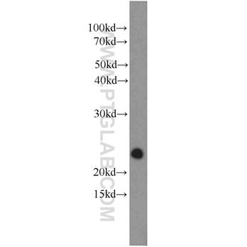 RRAS2 Rabbit Polyclonal Antibody (12530-1-AP)