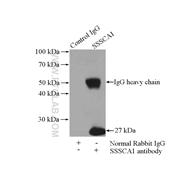 SSSCA1 Rabbit Polyclonal Antibody (12273-1-AP)