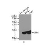 VTI1A Rabbit Polyclonal Antibody (12354-1-AP)